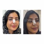 کلینیک تخصصی ژل و بوتاکس مرضیه آقابابایی