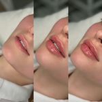 کلینیک لیزر و زیبایی پرین