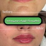 کلینیک تخصصی لیزر پوست مو مه سیما