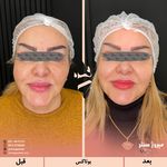 مرکز پزشکی و زیبایی میروژ سنتر