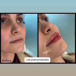 مطب پوست زيبايی ليزر دکتر شاه نعمت الهی