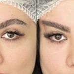 کلینیک زیبایی الماس کاملا اقساطی