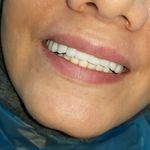 مطب ایمپلنت دکتر نیما شفیعی