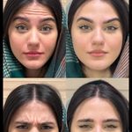 کلینیک پوست مو زیبایی دکتر نینا