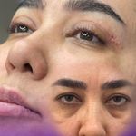 کلینیک لیزر و زیبایی دایان