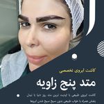 کاشت ابرو سلطانی متد پنج زاویه