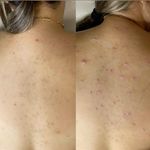 کلینیک زیبایی، فیشال امینی