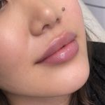 کلینیک زیبایی پوستینو