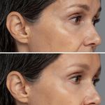 خدمات تخصصی پاکسازی پوست هدیه حامدی