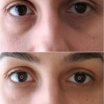 کلینیک پوست و مو و زیبایی هروی