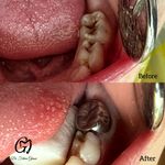 مطب دندانپزشکی دکتر فاطمه قانعی گلبهار