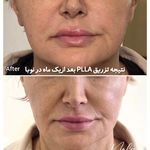 کلینیک زیبایی و لیزر مو زائد نوبا