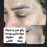 مرکز تخصصی مراقبت های پوستی مهدیه بینایی