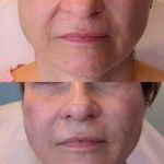 کلینیک پوست و مو و زیبایی هروی