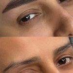 میکروکیماسی( میکروابرو چشم لب،ریمو)