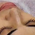 خدمات تخصصی پاکسازی پوست و فیشال مهسا