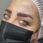 میکرو فیبروز هشتگرد بیتا