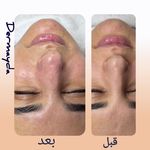 مرکز لیزر و فیشال دکتر خالقیان