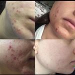 فیشال الا اسکین
