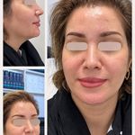 کلینیک پوست،مو،زیبایی و لیزر دالیا