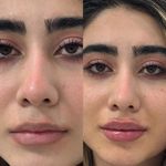 کلینیک پوست و لیزر نهال