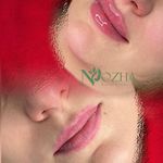 کلینیک پوست،مو،زیبایی و مرکز لیزر نوژا
