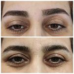 اصلاح تخصصی وترمیمی ابروی فرزانه