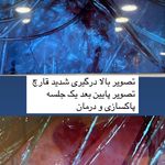 کلینیک پاکسازی و فیشیال پوست سالاری