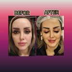 مطب پوست ،مو و لیزر یسنا طب