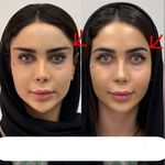 کلینیک ژل بوتاکس لیزر فیل بیوتی