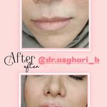 مطب زیبایی دکتر سیده زهرا حسینی