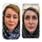 کلینیک تخصصی ژل و بوتاکس مرضیه آقابابایی
