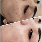 فیشیال / خدمات پوست / سالن زیبایی