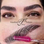 آرایش دائم وریموو تراپی پوست گندم فلاحی