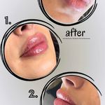 مرکز زیبایی و لاغری روژه