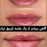 کلینیک پوست و زیبایی آرین