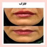 مرکز لیزر و کلینیک زیبایی بهاران