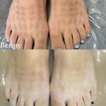 فیشال و پاکسازی پوست مرضیه صالحی
