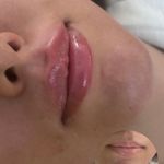 مرکز لیزر و کلینیک زیبایی پریفا
