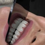 کلینیک‌دندانپزشکی دنتال آرنا-بیمه نیستیم