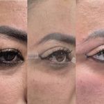 پاکسازی و فیشال تخصصی پوست جنابی،آموزش