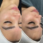 خدمات تخصصی فیشیال پوست حسینی
