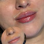 مرکز لیزر ،پوست و زیبایی کندی بیوتی
