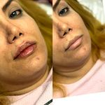 کلینیک تخصصی لیزر موهای زائد پریناز شرق