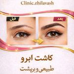 کلینیک پوست و زیبایی ژیلاوَش