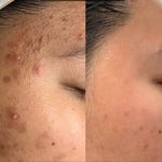 فیشال و اسکراپ اسکالپ عاطفه