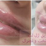 کلینیک زیبایی و لیزر مایا (دکتر وحیدی)
