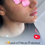 مرکز لیزر و کلینیک زیبایی پریفا