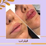 مرکز لیزر مرکز زیبایی دکتر مهسا رحیمی