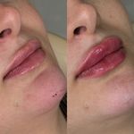 کلینیک تخصصی زیبایی و لیزر ویان